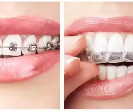 Orthodontics & Braces